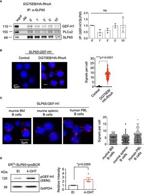 The Small GTPase RHOA Links SLP65 Activation to PTEN Function in Pre B Cells and Is Essential for the Generation and Survival of Normal and Malignant B Cells